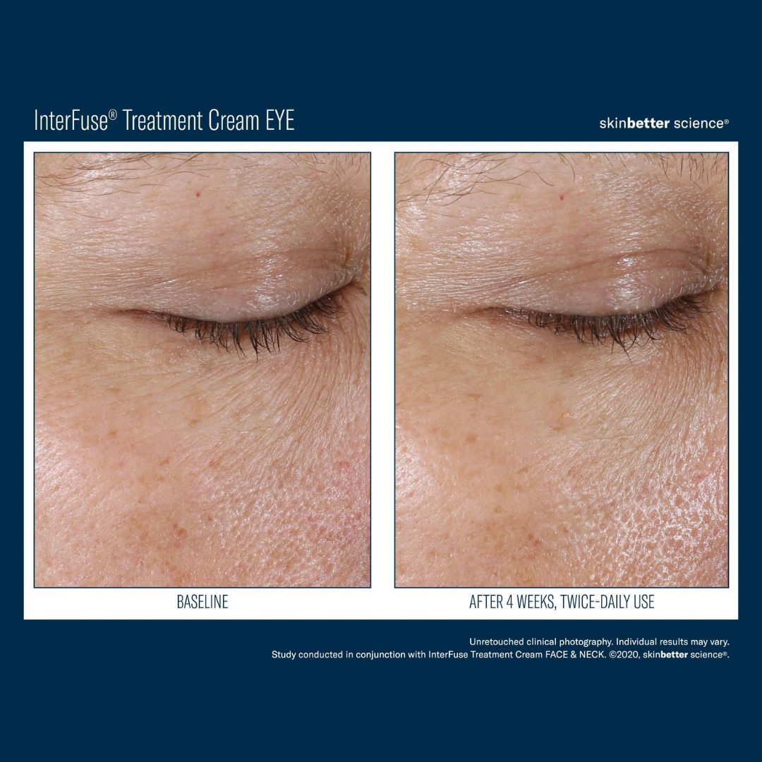 SKINBETTER SCIENCE® InterFuse Treatment Cream EYE