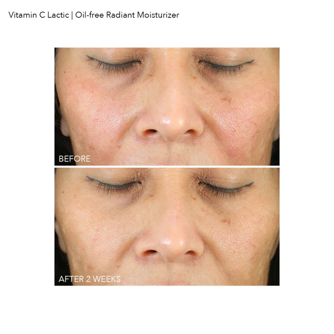 Dr Dennis Gross® Oil-Free Radiant Moisturizer 50ml