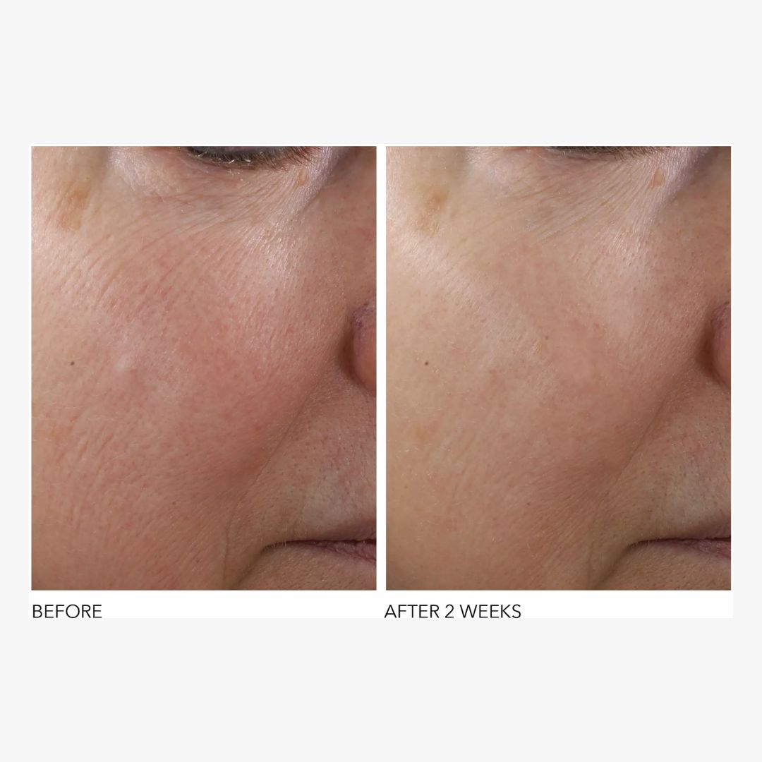 Dr Dennis Gross® Texture Renewal Serum 30ml