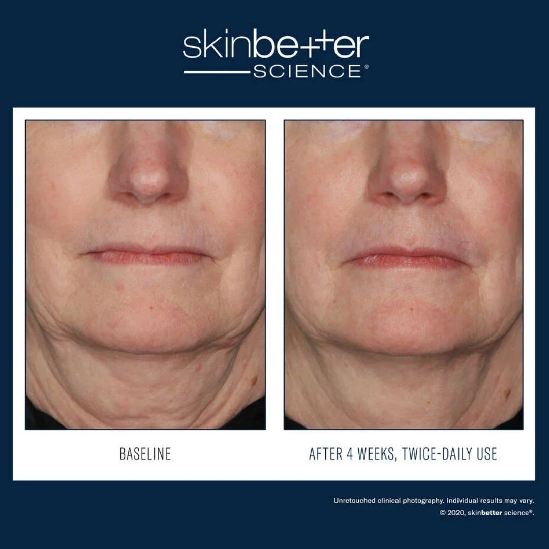 SKINBETTER SCIENCE® InterFuse Treatment Cream FACE & NECK
