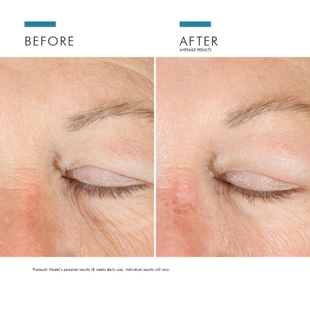 Skinceuticals® A.G.E Advanced Eye 15ml