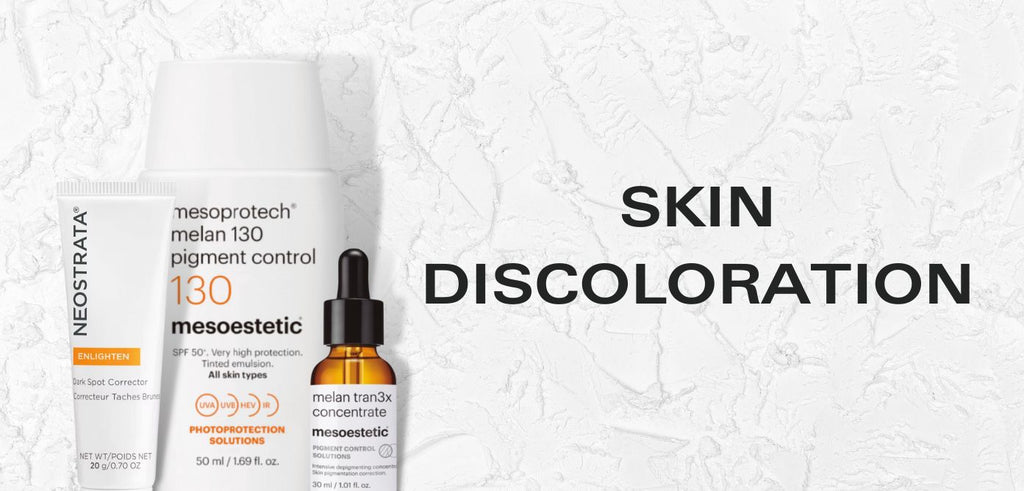 skin discoloration